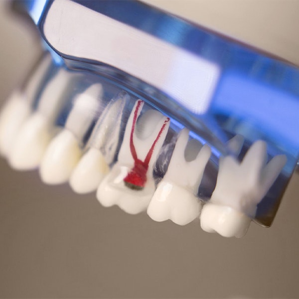 Root canal model
