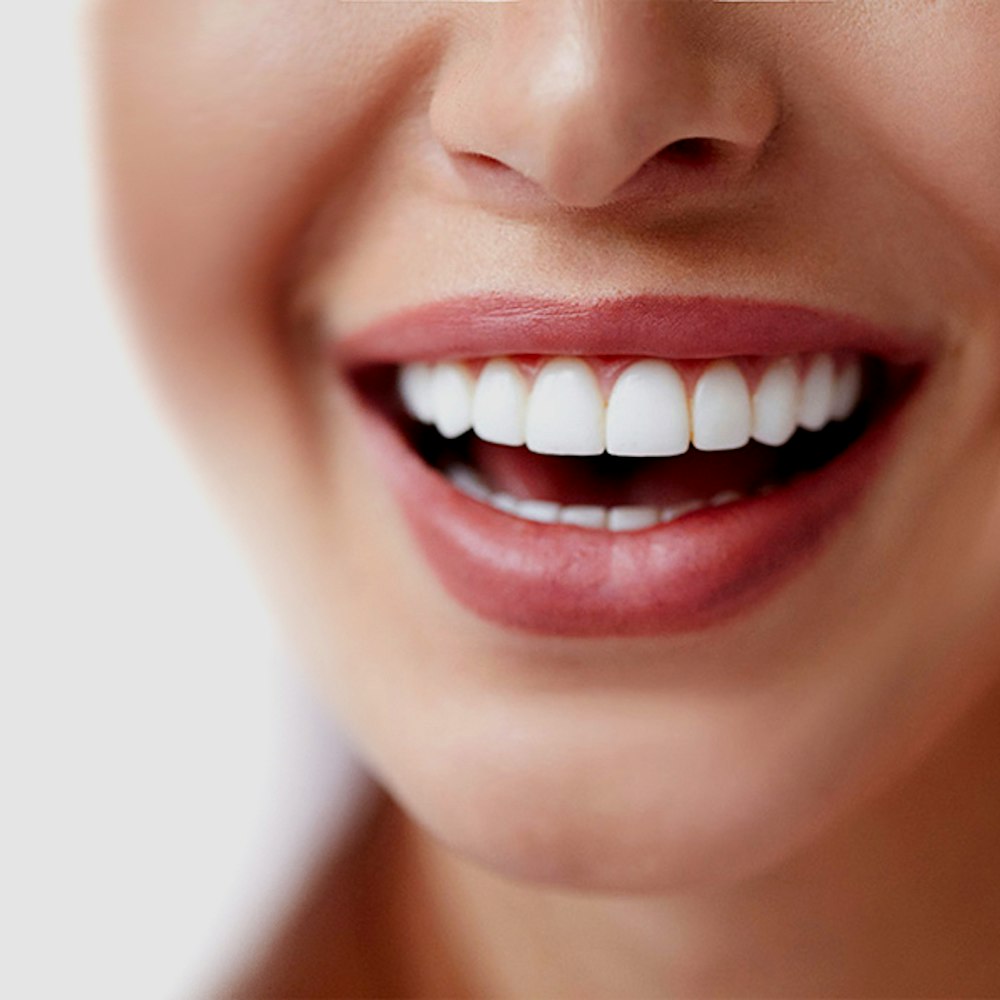 Woman with Smile Makeover