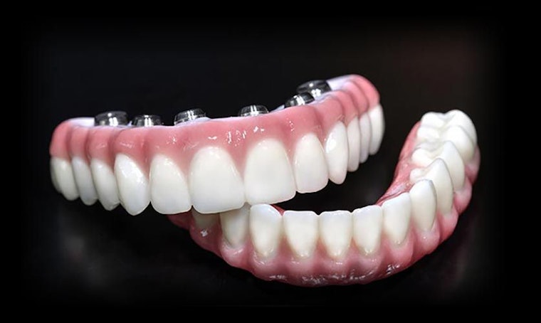 Teeth Tomorrow bridges