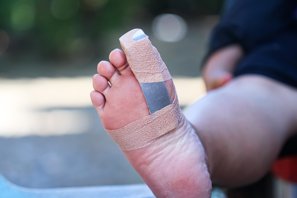Toe Splint
