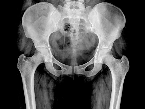 X-Ray