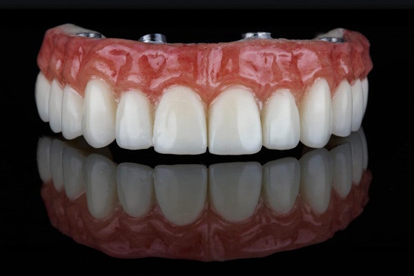 All-on-4 full-arch denture