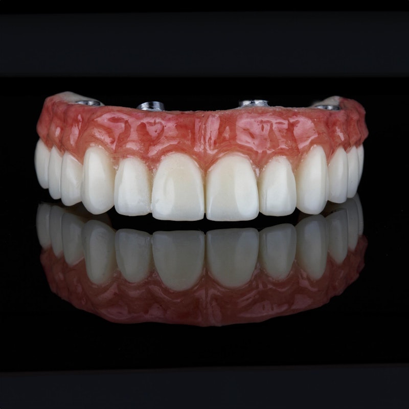 All-on-4 denture