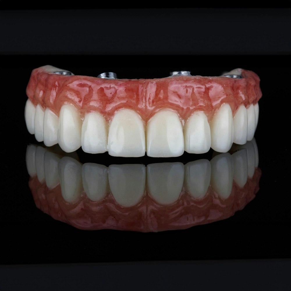 All-on-4 Implants