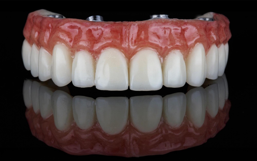 implant-supported denture