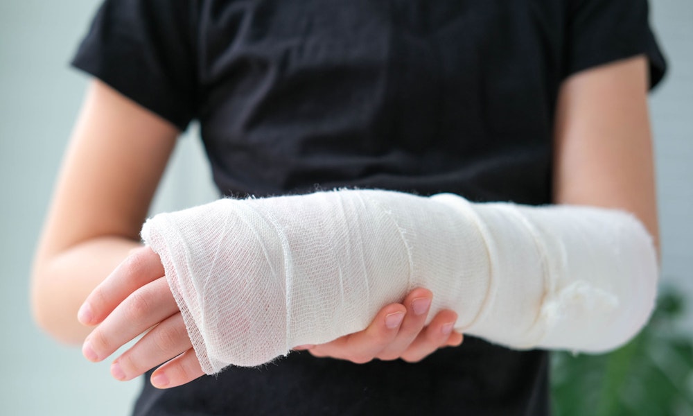 Person with arm cast