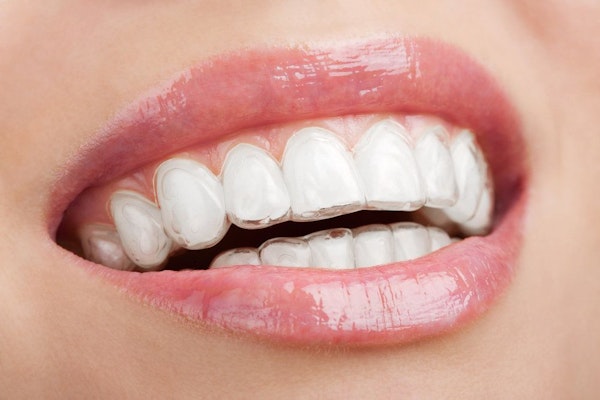 Woman wearing invisalign