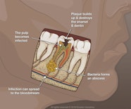 Root Canal Orland Park IL Premier Dental Implant Center