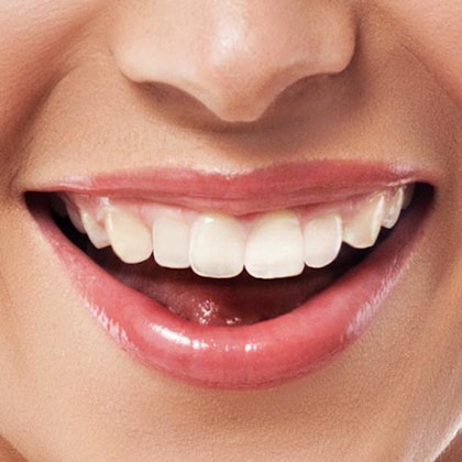 fixed women's smile