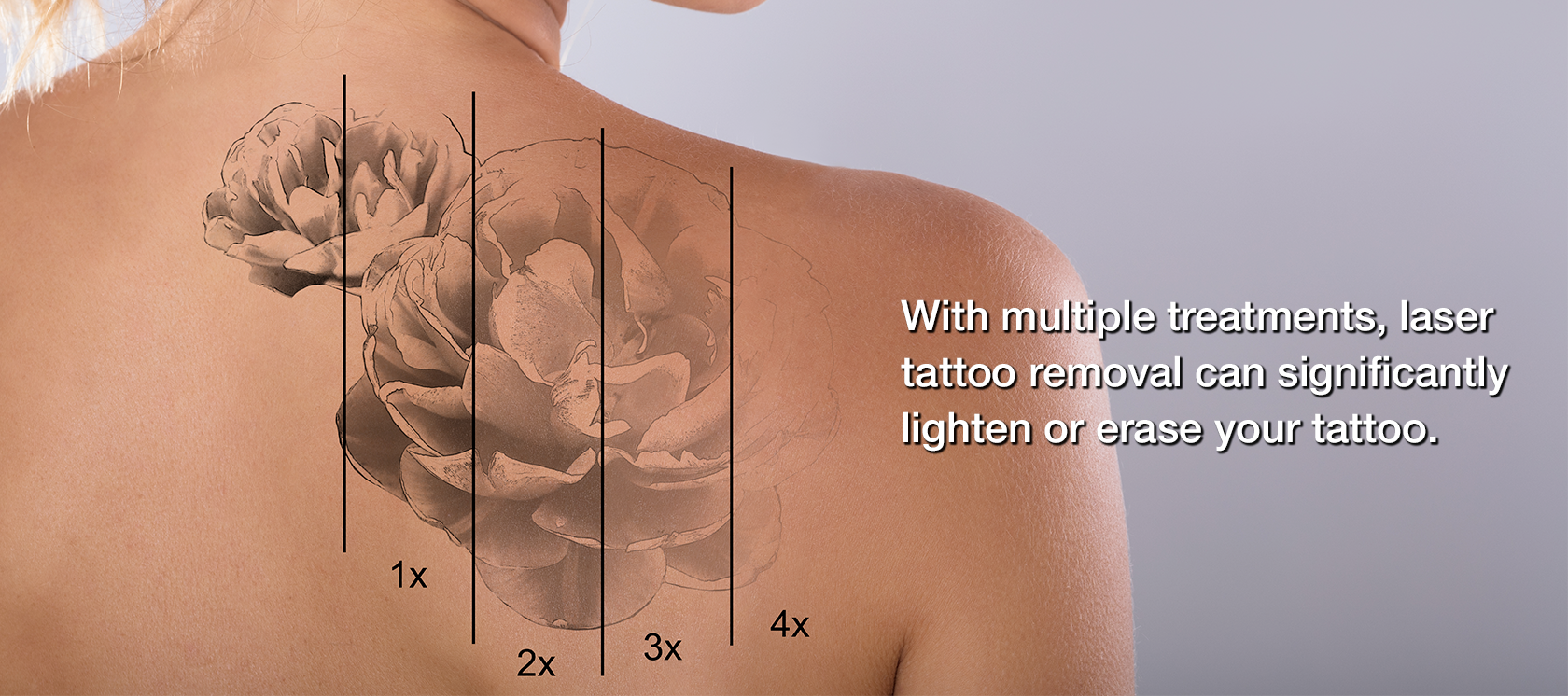 Flower tattoo superimposed over back of woman's shoulder