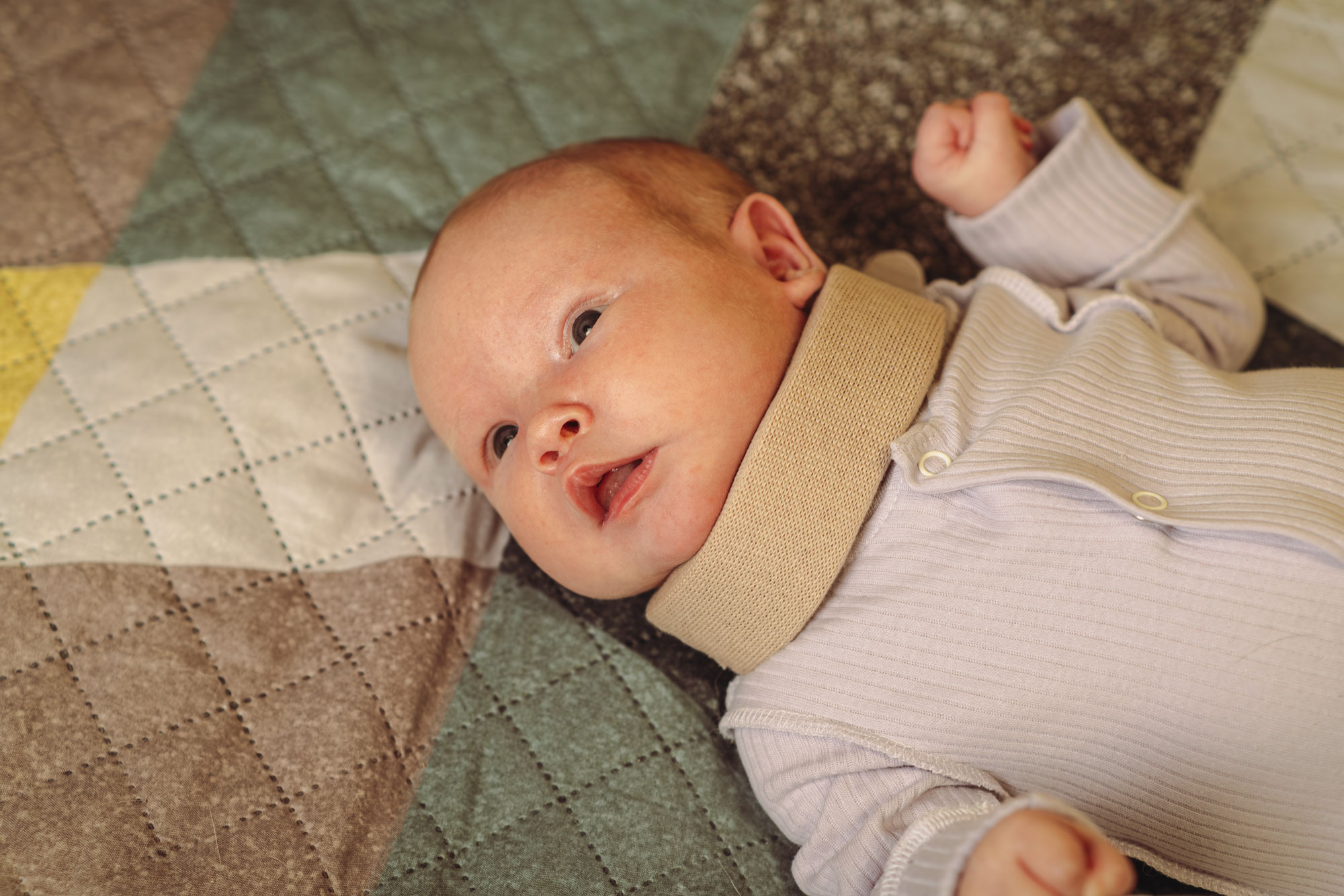 Baby with cervical brace around neck