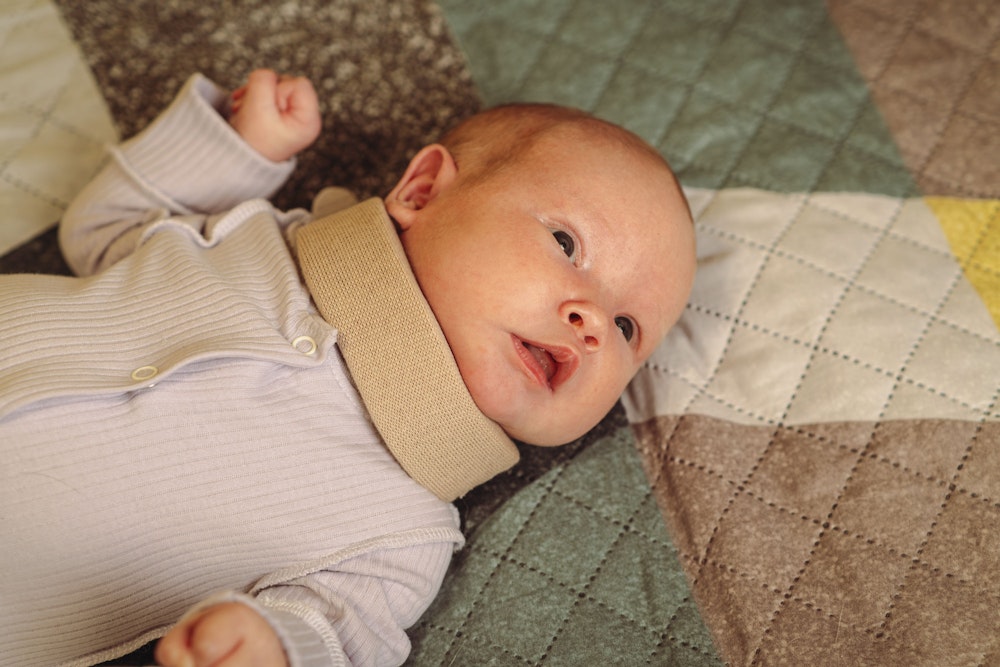 Baby with cervical brace around neck