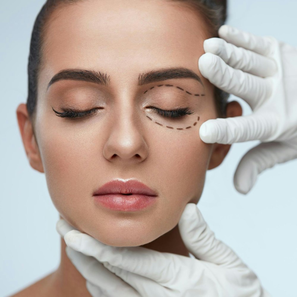 Blepharoplasty patient