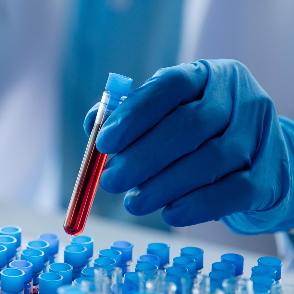 hand holding Blood Tests