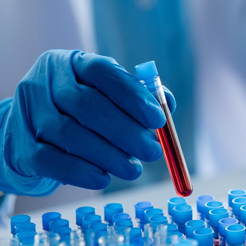 hand holding Blood Tests