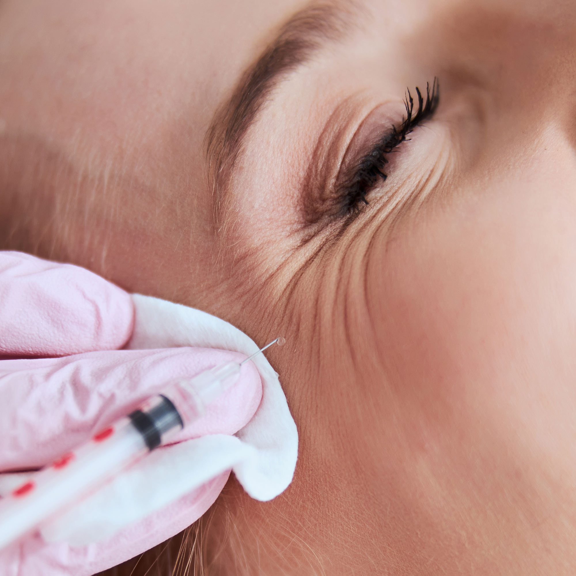 Woman receiving BOTOX for crow's feet