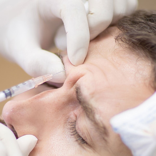 Injection into lines between eyebrows