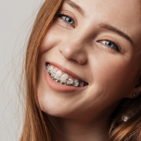 Young girl wearing Six Month Smiles®