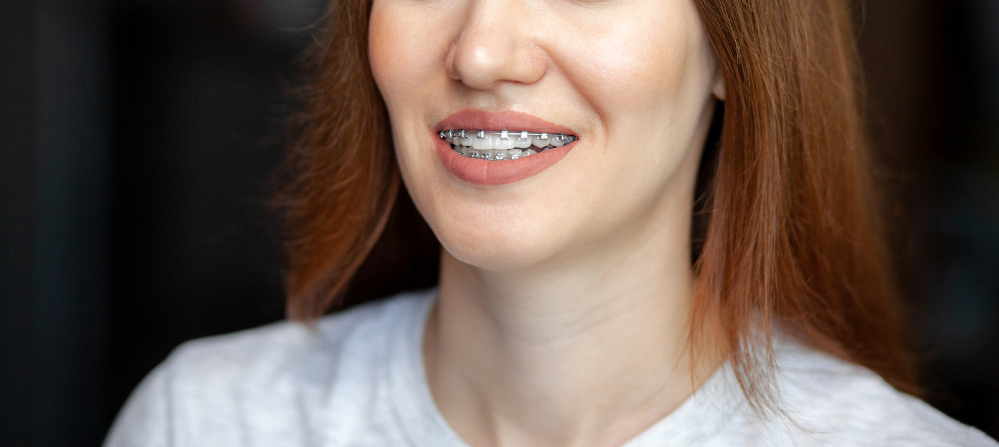 Smiling woman wearing braces