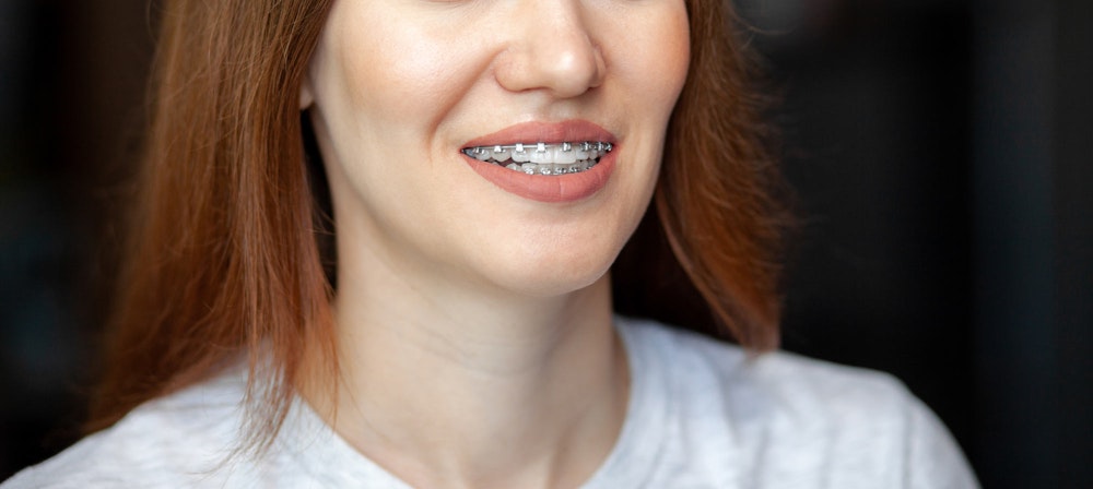 Smiling woman wearing braces