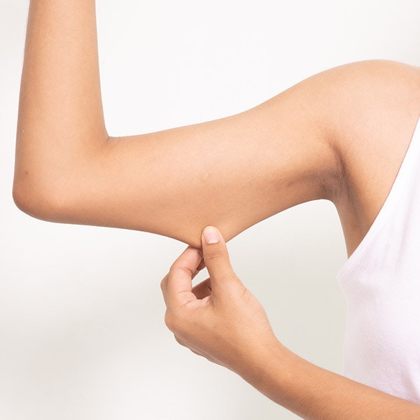 Brachioplasty