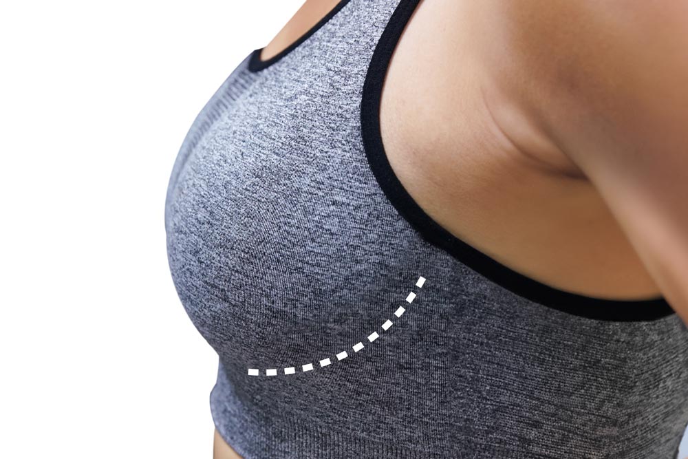 Side profile of breasts in sports bra with incision mark