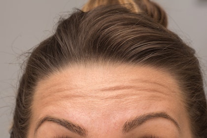 Close up of woman's brow lines