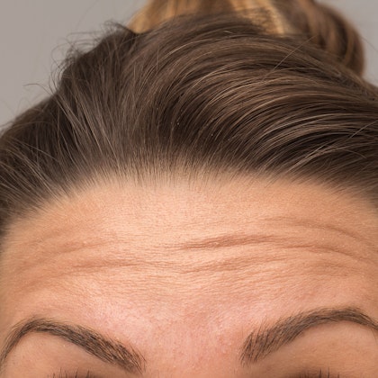Close up of woman's brow lines