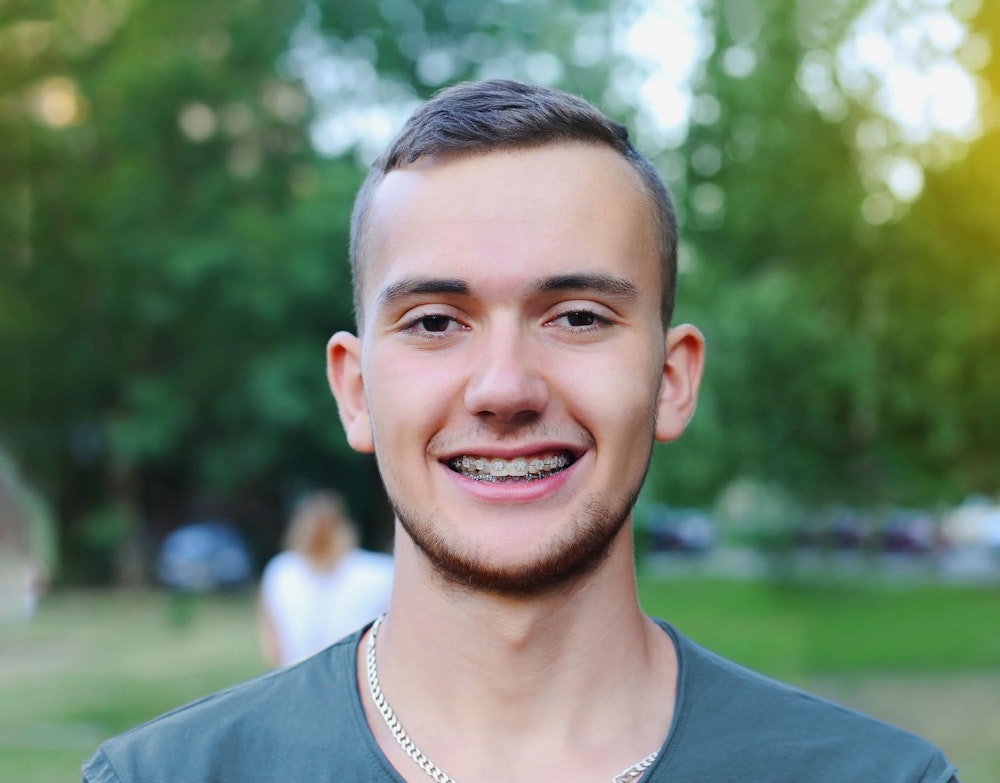 Smiling young man wearing Ceramic Braces