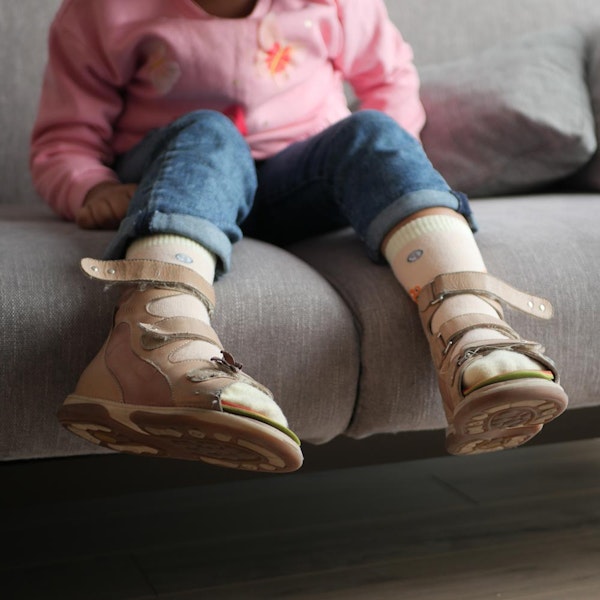 Child with cerebral palsy's legs