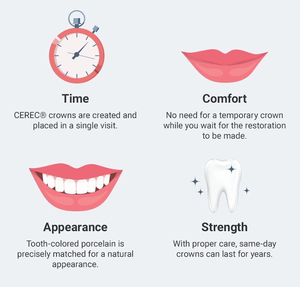 illustration of CEREC dental crown timeline