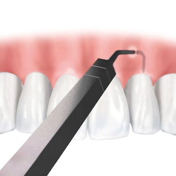 Gum Contouring Newport, TN - Newport Family Dental Care, PLLC