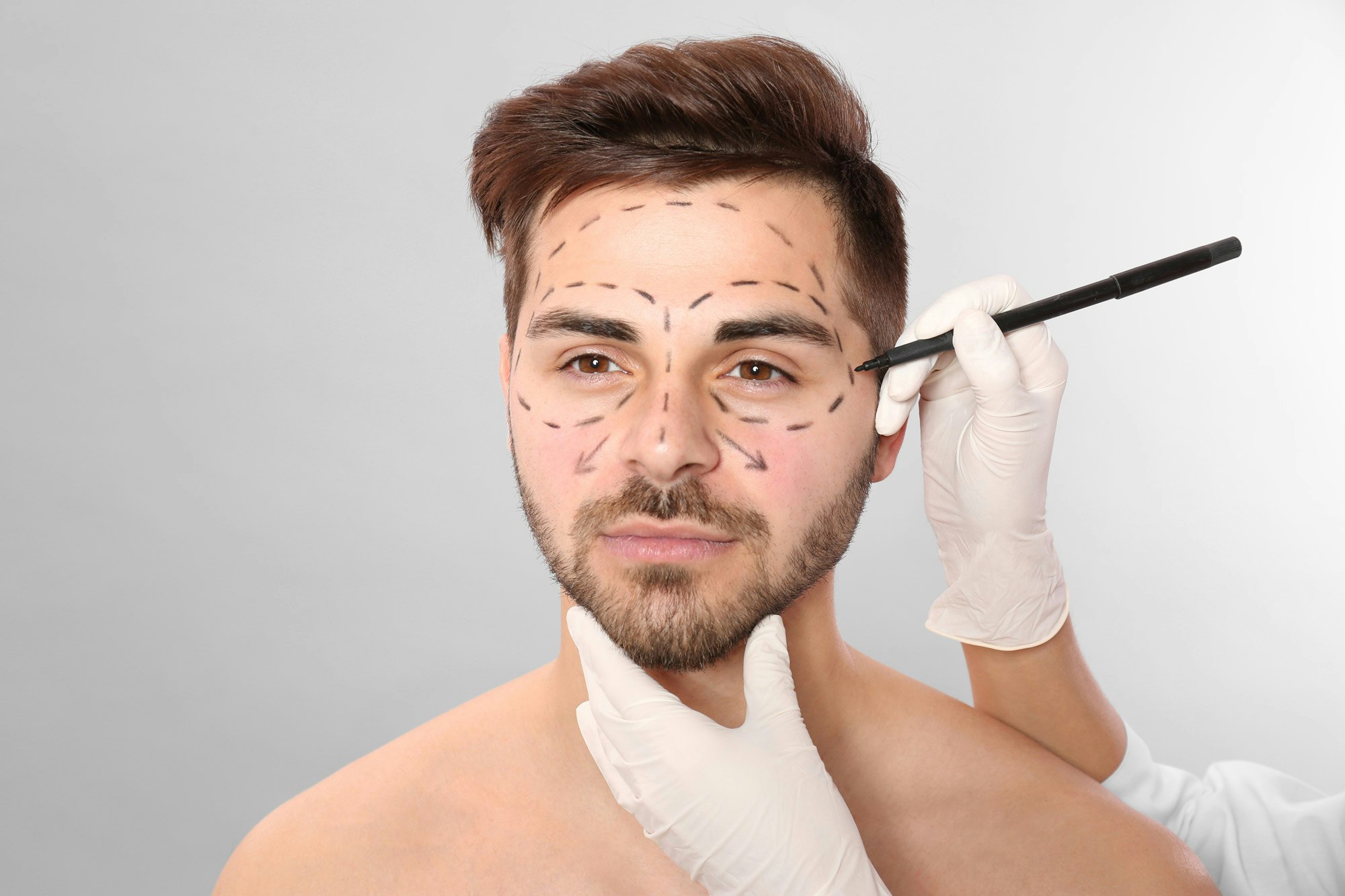 Man with cosmetic surgery lines drawn on face