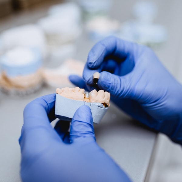 Ceramist designing a dental implant