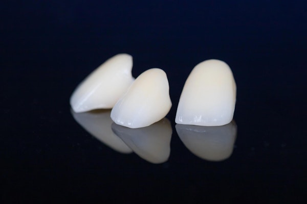 Dental crowns