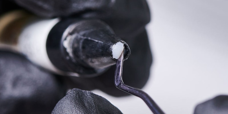 dentist prepping tooth-colored material for dental bonding procedure