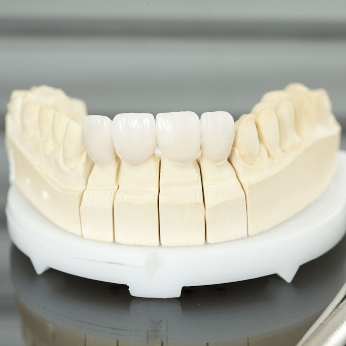 Dental bridge model