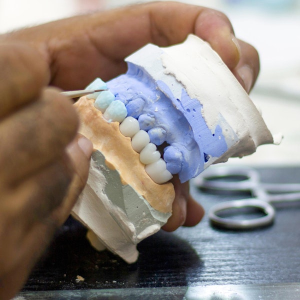 Painting dental bridge