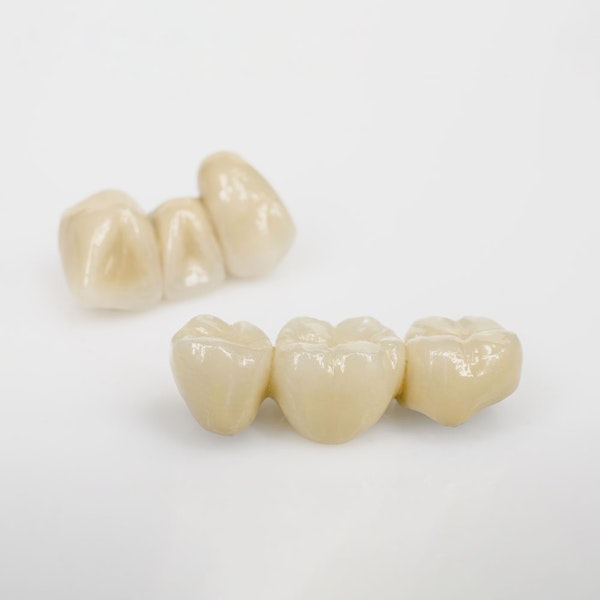 Dental bridges