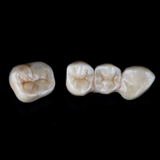 Dental Crowns Washington, DC Tooth Crown Thornton Dental Associates