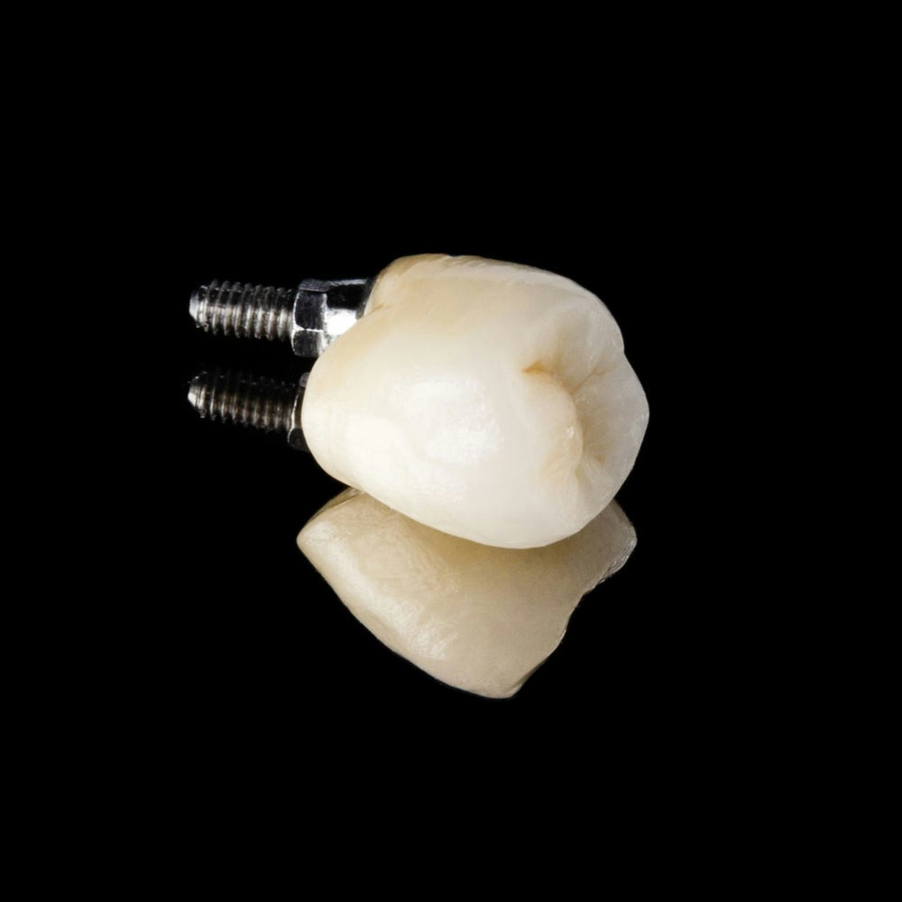 Implant-supported crown