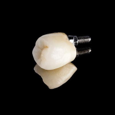 implant-supported crown