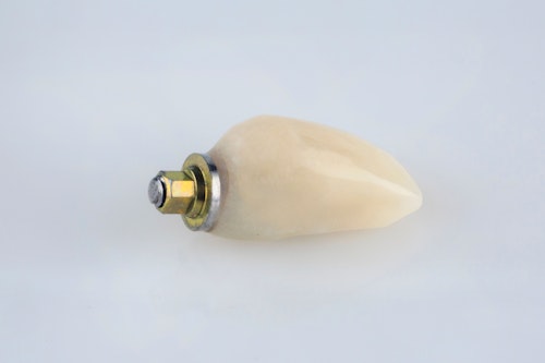 Implant-supported crown