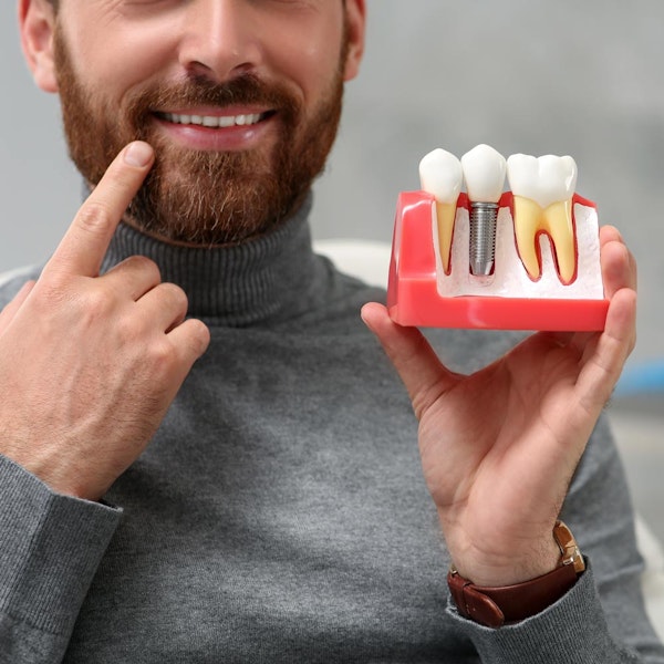 Man pointing to dental implant while holding dental implant model