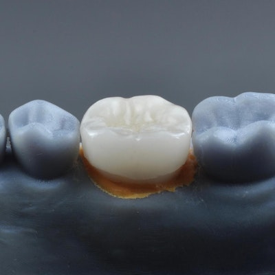 a dental crown over a model tooth