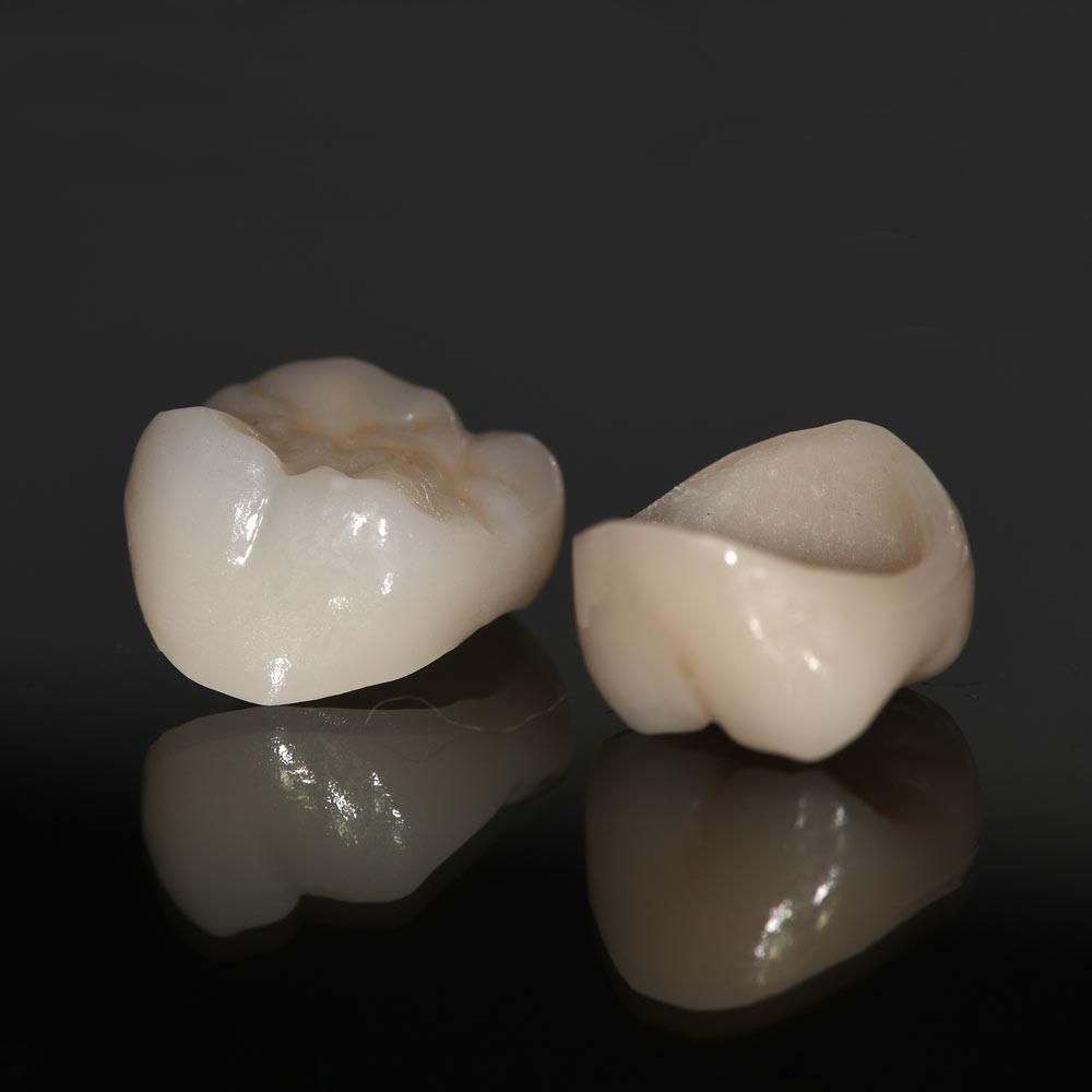 Dental crowns