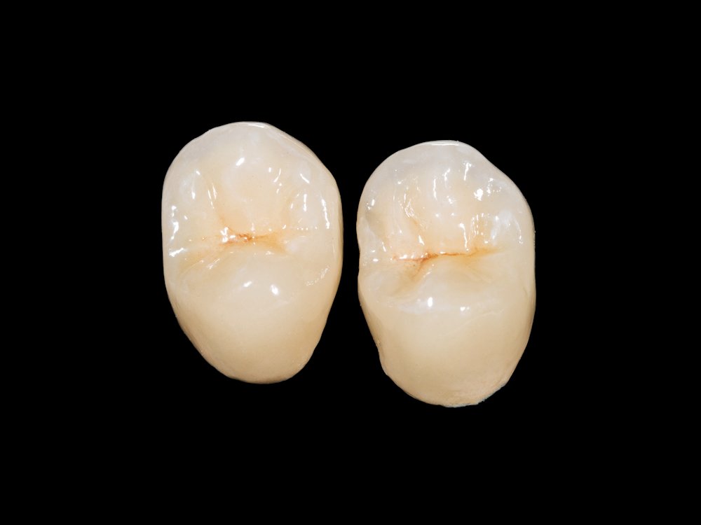 Dental crowns