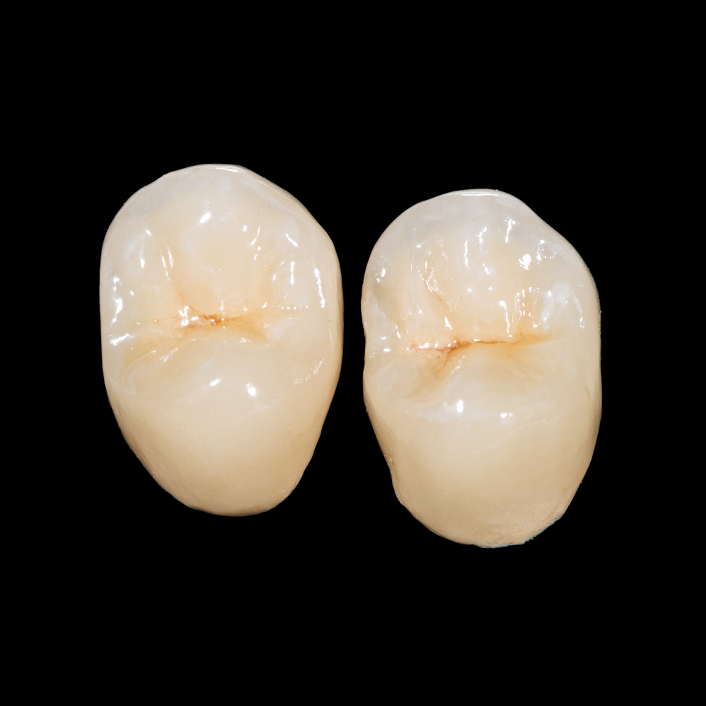 Dental crowns