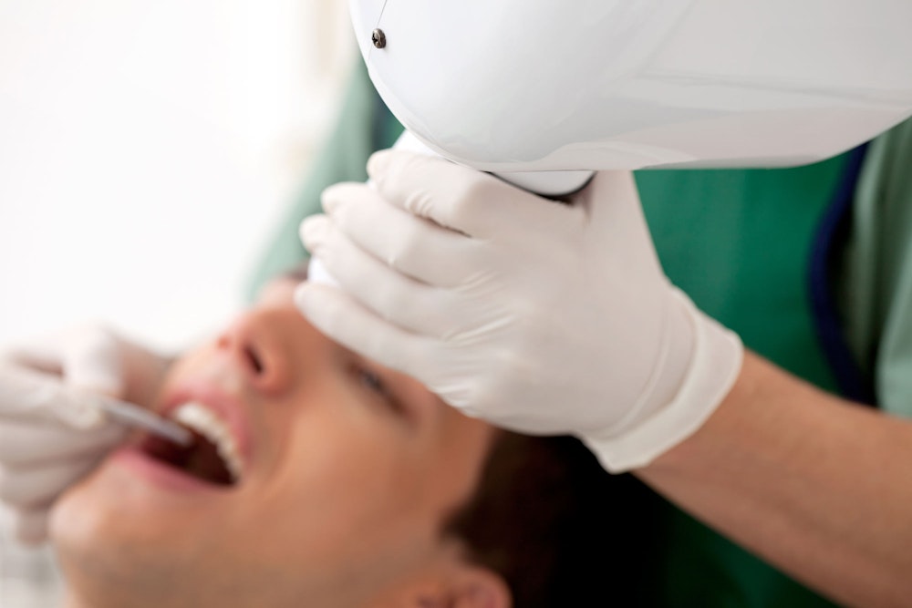 dental x-rays