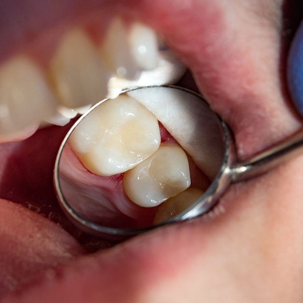 Dental tool and filling